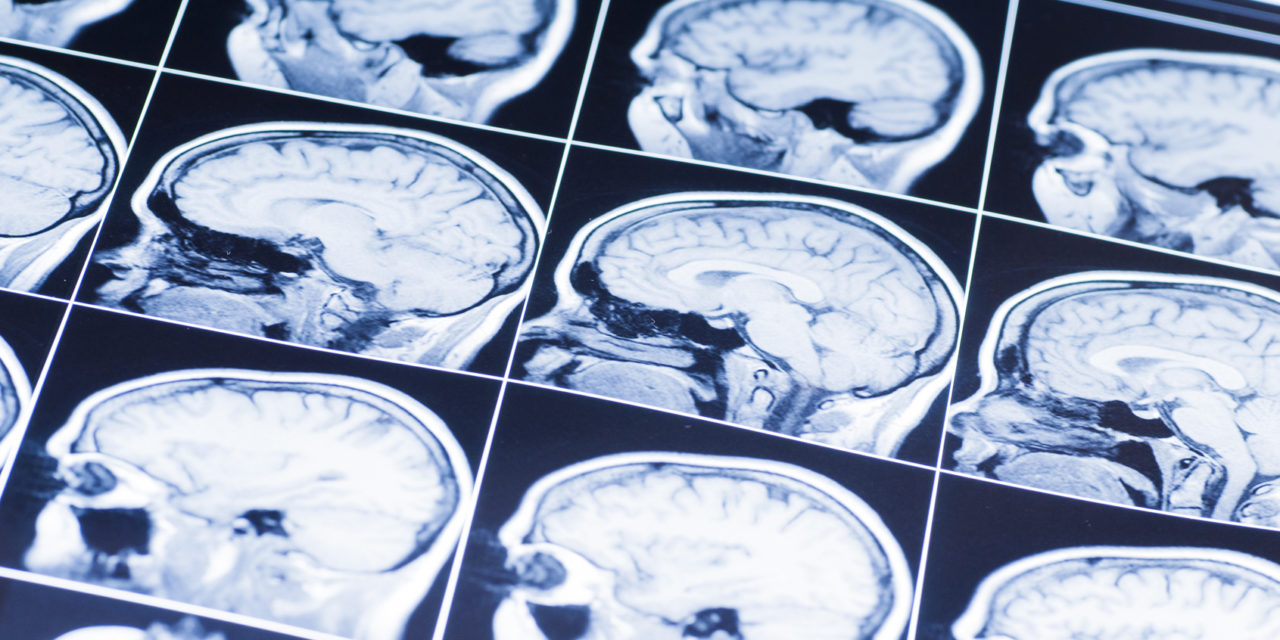 Meet the Innovations Changing the World of Traumatic Brain Injury Diagnosis and Treatment