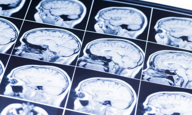 Meet the Innovations Changing the World of Traumatic Brain Injury Diagnosis and Treatment